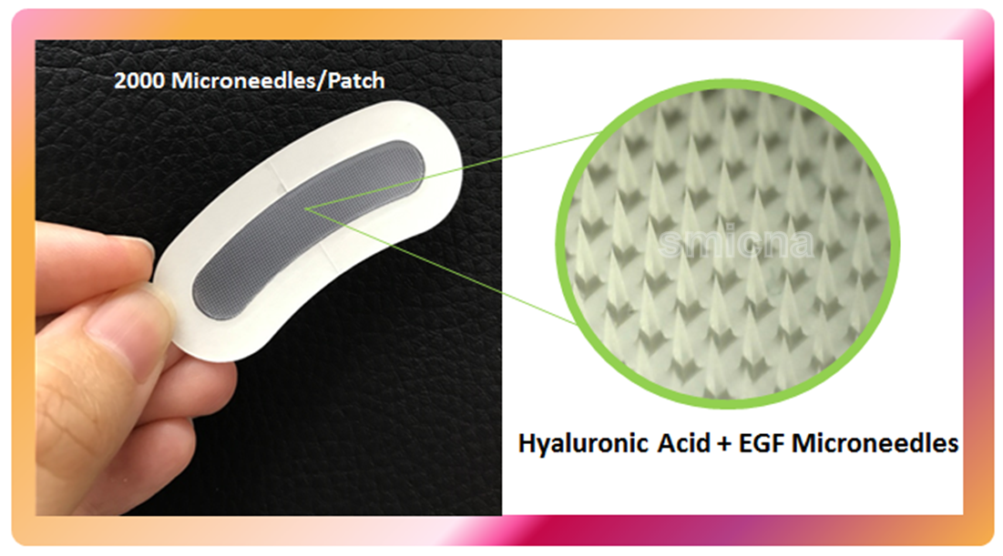 microneedles patch